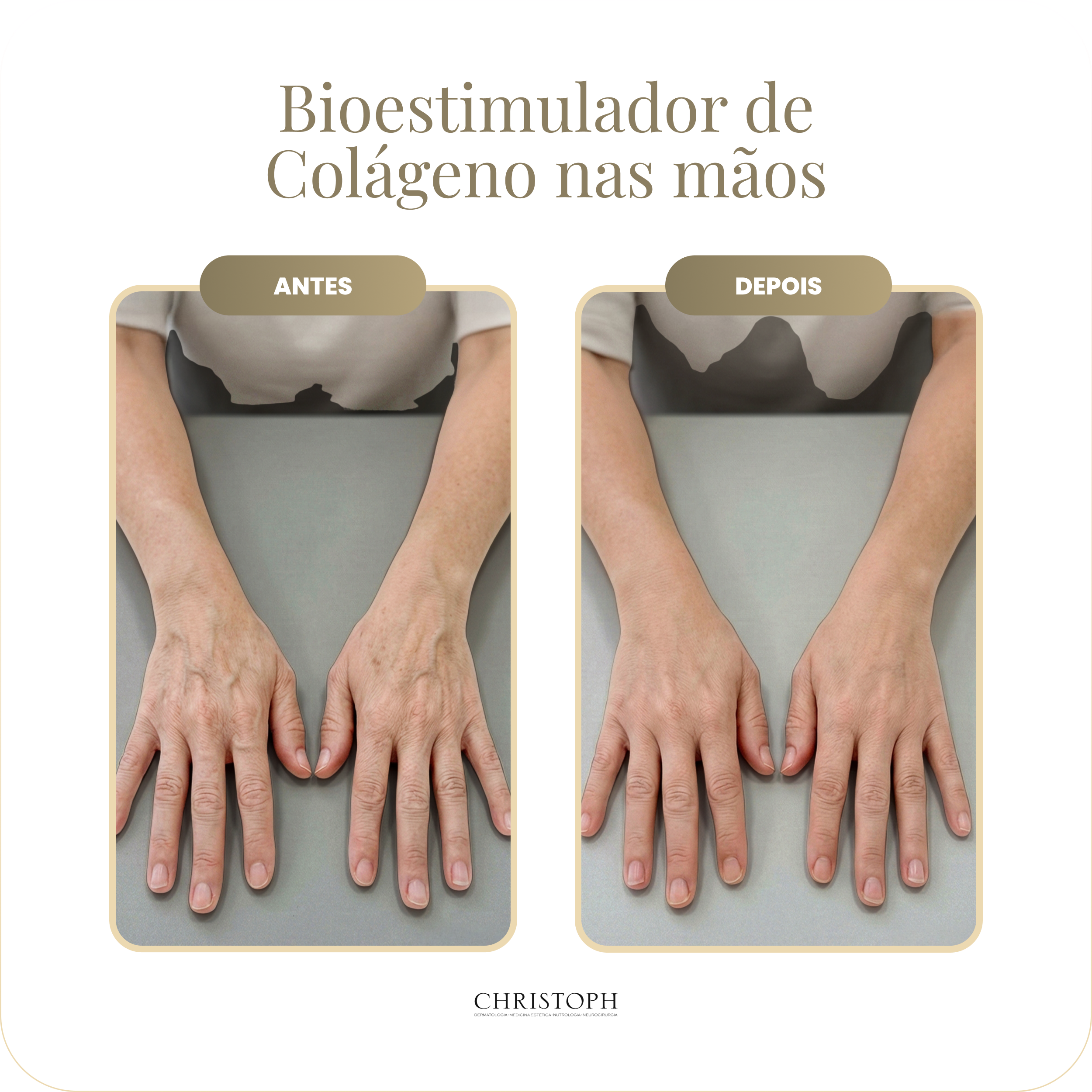 bioestimulador_de_col_geno_nas_m_os.webp