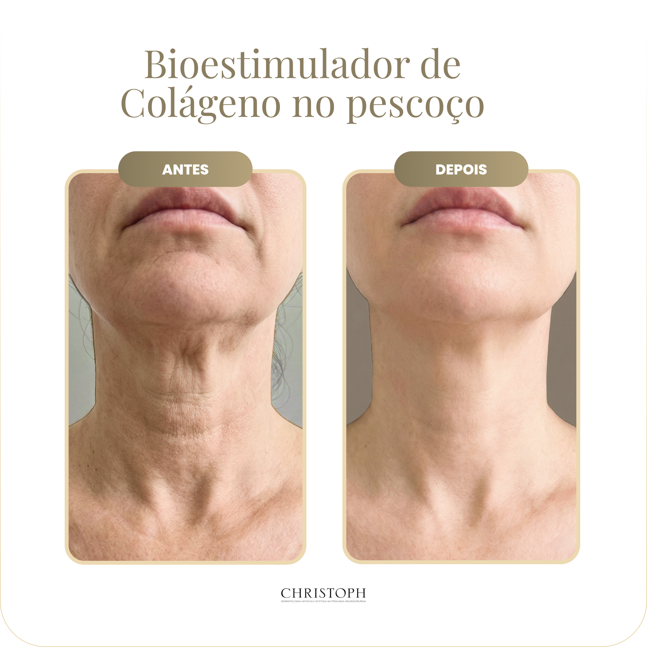 bioestimulador_de_col_geno_no_pesco_o.webp